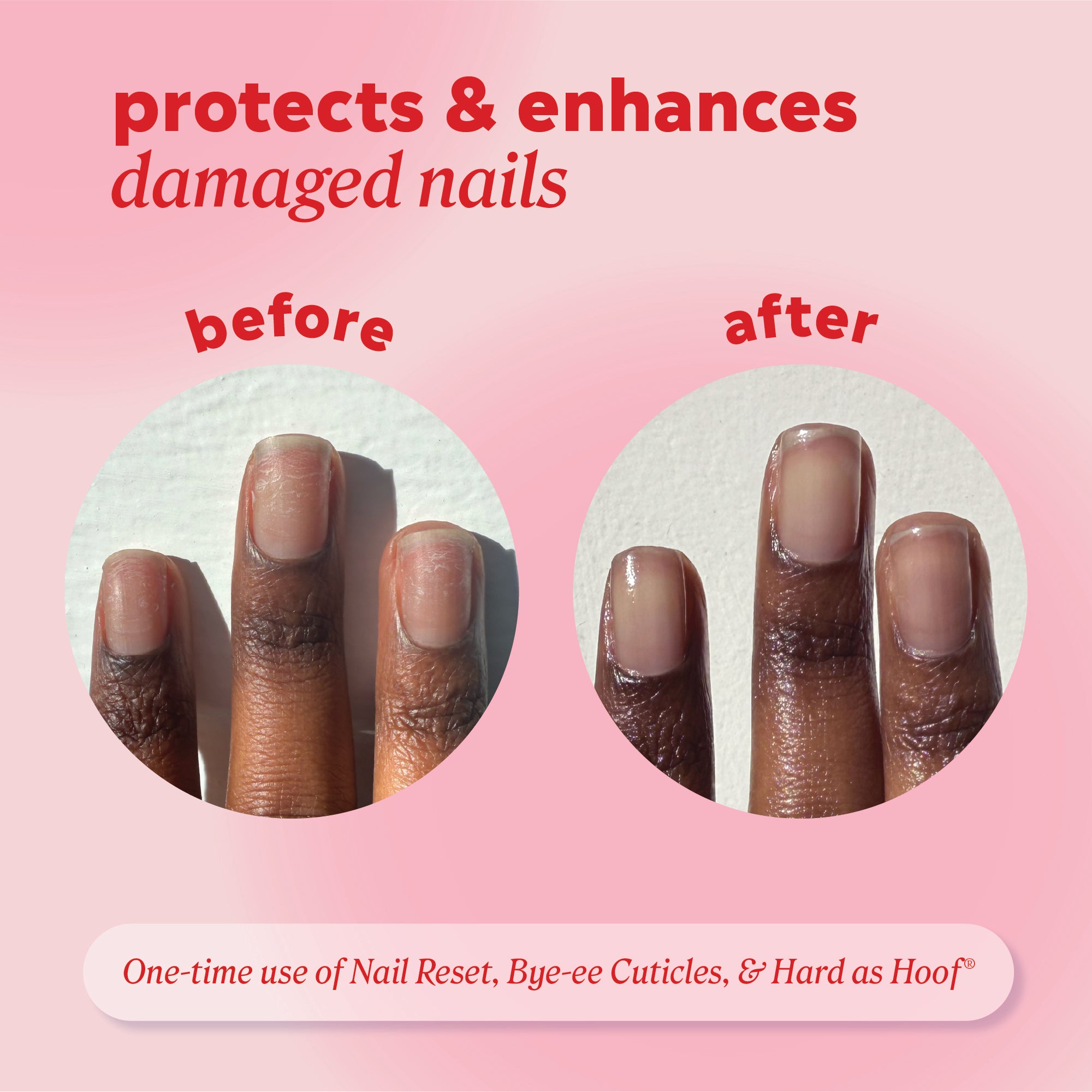 Fingernails shown “before” and “after” use with header text “protects & enhances damaged nails” and note reading “One‑time use of Nail Reset, Bye‑ee Cuticles, & Hard as Hoof.”