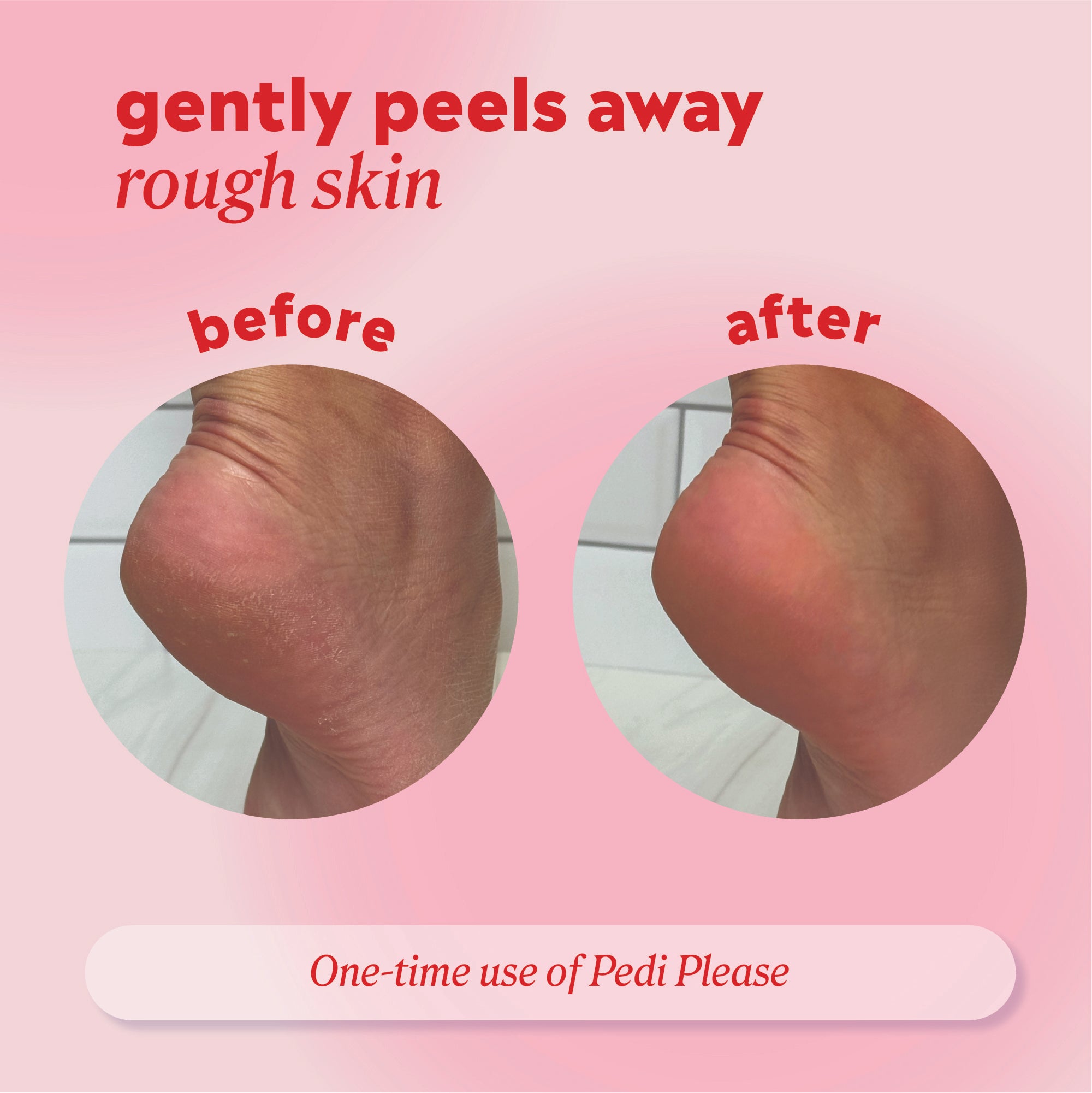 Side‑by‑side close‑up of a heel labeled ‘before’ and ‘after,’ showing rough skin appearing smoother after using Pedi Please.
