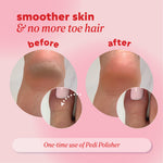 Side‑by‑side images of a heel labeled ‘before’ and ‘after,’ showing smoother skin with reduced coarse texture. Text above reads ‘smoother skin & no more toe hair.’