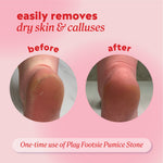 Heel shown “before” and “after” using the pumice stone with header text “easily removes dry skin & calluses” and note “One‑time use of Play Footsie Pumice Stone.”