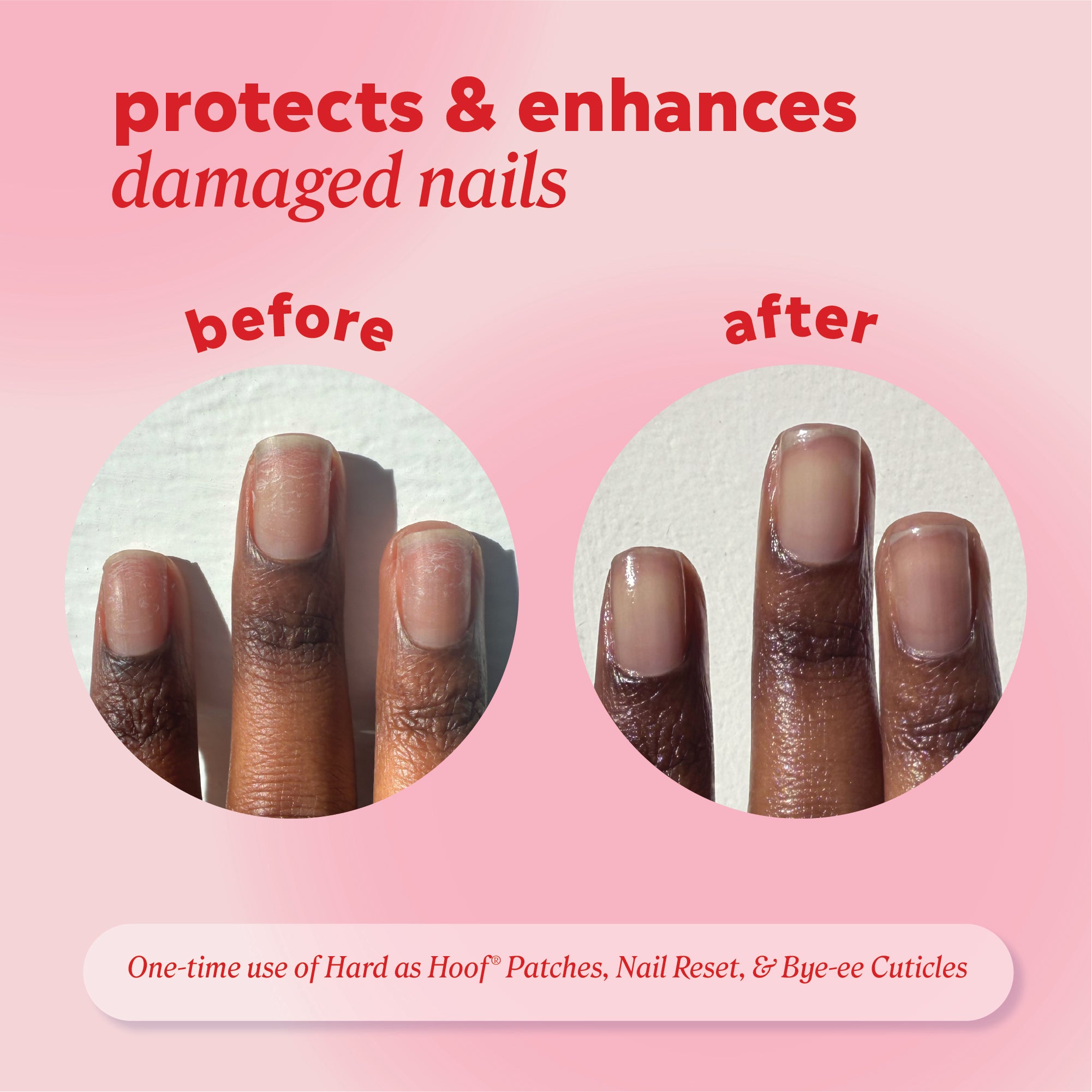 Fingernails shown “before” and “after” use with header text “protects & enhances damaged nails” and note referencing one‑time use of Hard as Hoof patches, Nail Reset, and Bye‑ee Cuticles.