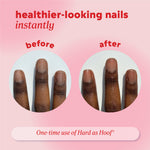 Before‑and‑after comparison of fingernails. Top text reads ‘healthier‑looking nails instantly.’ Left circle labeled ‘before,’ right circle labeled ‘after.’ Text at the bottom reads ‘One‑time use of Hard as Hoof.’
