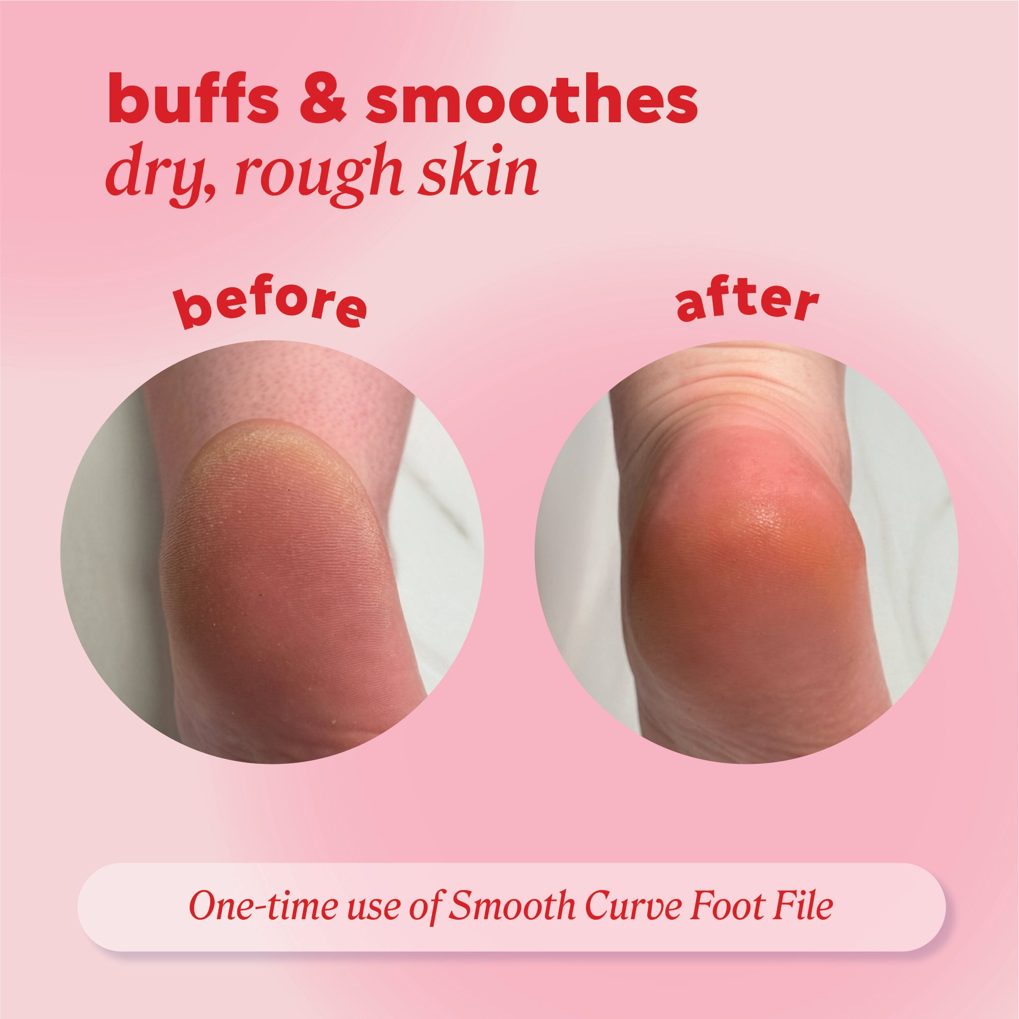 Reads, "buffs and smoothes dry, rough skin." Two images of a heel labeled before and after; the first shows dry, cracked skin, and the second shows smoother skin with reduced dryness overall area.