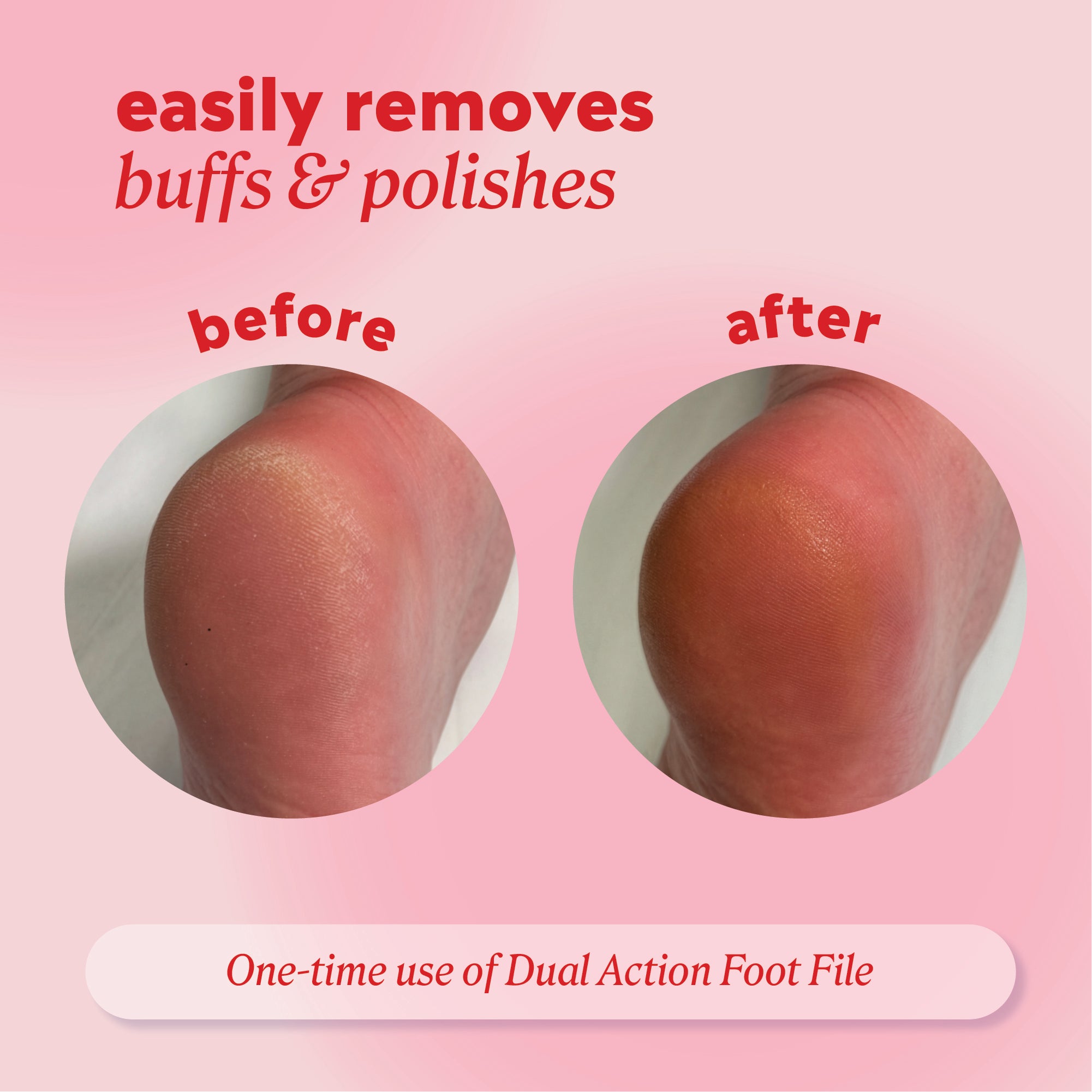 Heel shown “before” and “after” using the polisher with header text “easily removes buffs & polishes” and note “One‑time use of Dual Action Foot File.”