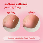 Graphic with the text ‘softens calluses for easy filing.’ Shows a before image of a heel with visible callused skin and an after image of the same heel with the callused area visibly reduced. Text at the bottom reads ‘One‑time use of Callus Care and Foot File.’