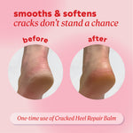 Before and after comparison of cracked heel repair balm on a pink background