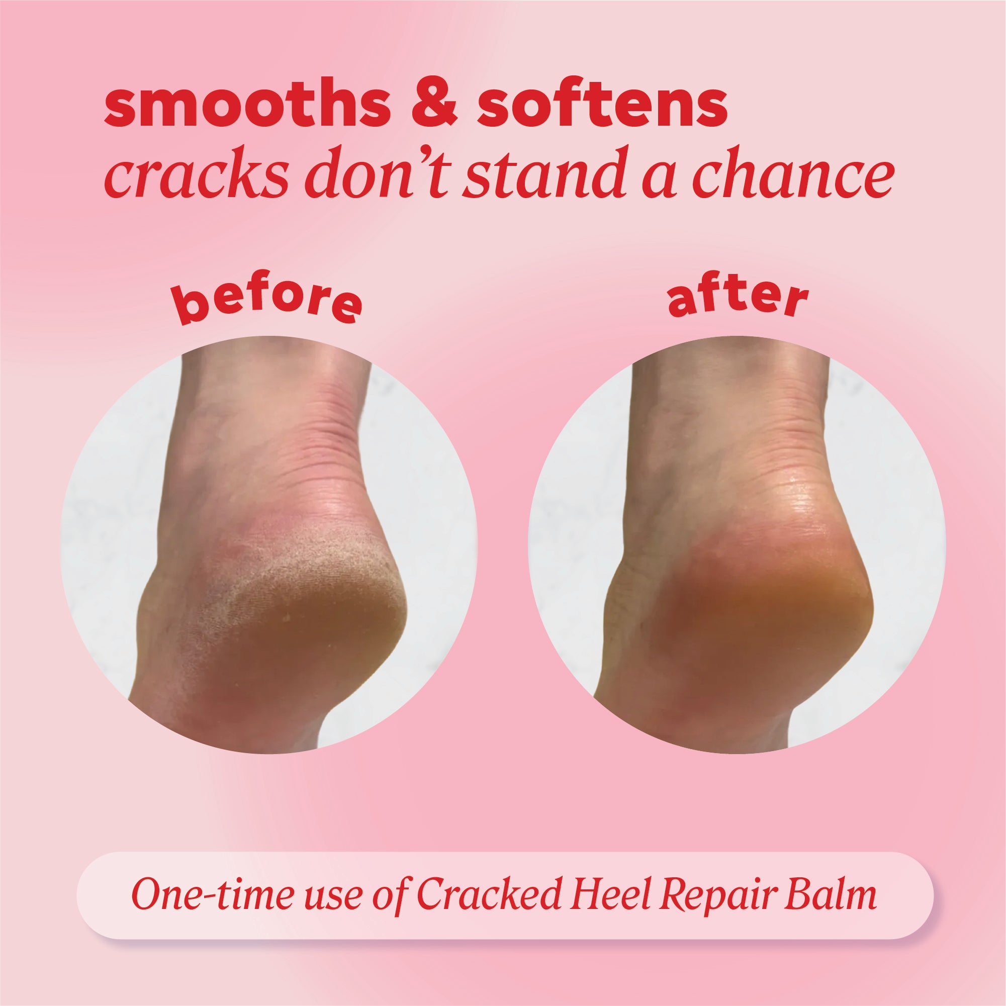 Before and after comparison of cracked heel repair balm on a pink background