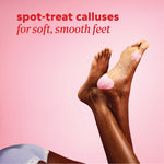 Two feet shown crossed at the ankles on a pink background with a pink callus pad applied to one heel. Text above reads ‘spot‑treat calluses for soft, smooth feet.’